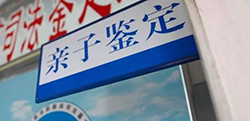 舟山上户亲子鉴定需要怎么办理呢，舟山上户口亲子鉴定多久得到结果
