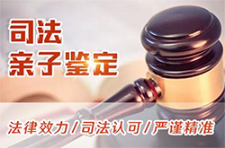 舟山群岛司法亲子鉴定如何办理专业咨询，舟山群岛司法亲子鉴定多少钱一次